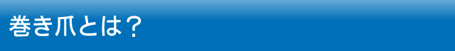 巻き爪とは？