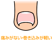 痛みがない・巻き込みが軽い