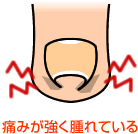 痛みが強く腫れている