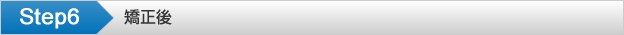 Step6 矯正後